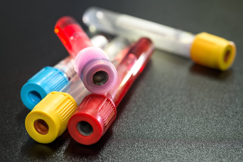 Vacuum blood collection tubes used for veterinary lab diagnostics and testing