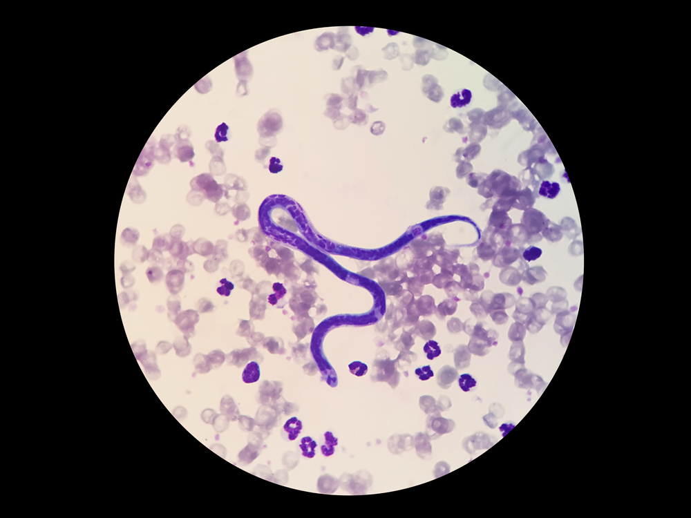 Microscopic blood smear showing microfilariae, used in heartworm diagnosis for pets
